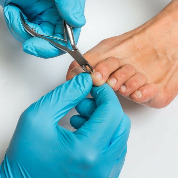 Nail cutting and nail trimming treatments from A Step Ahead Podiatry - foot health and podiatry in Glasgow and Obam