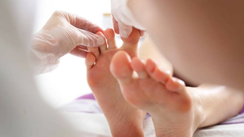 Podiatrist treating athlete's foot
