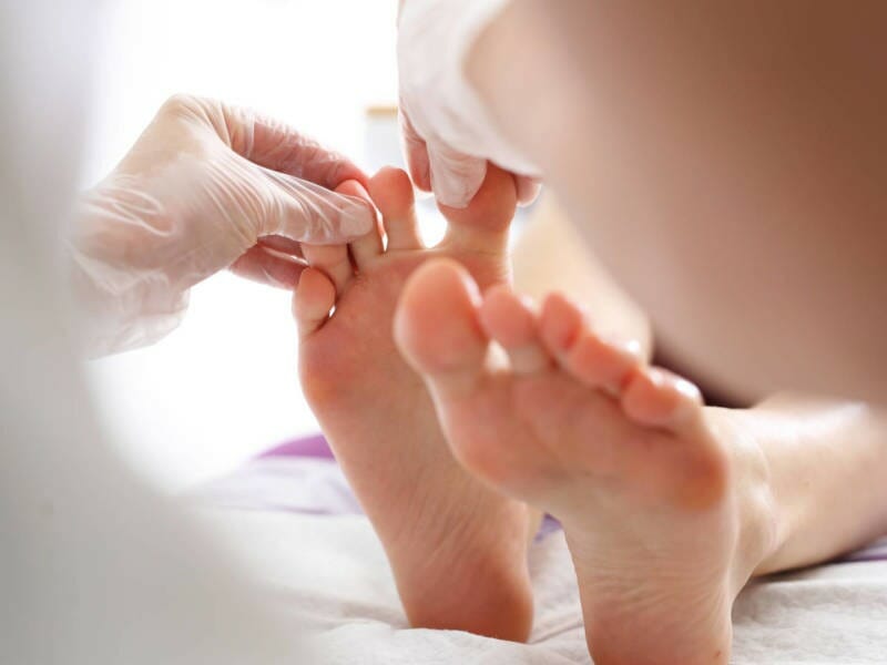 Podiatrist treating athlete's foot